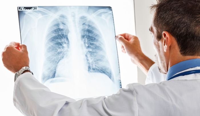 "Tüberküloz, Dünyadaki Dokuzuncu Ölüm Sebebi"