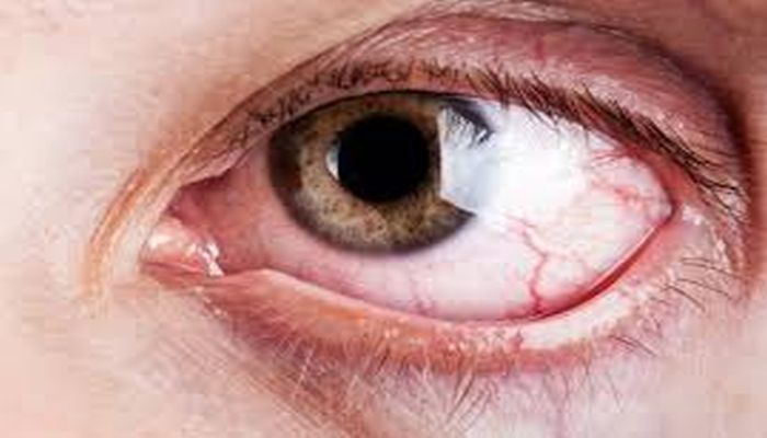 Göz kurumasına dikkat!