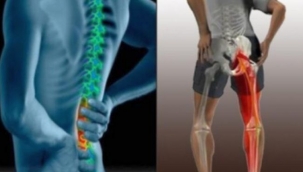 Gıcırdayan dizlerimiz ama kaynağı bel kireçlenmesi