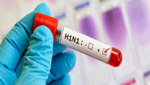 Domuz Gribi ve Soğuk Algınlığı Nasıl Ayırt Edilir?